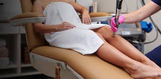 Book Your Laser Hair Removal Session at Renue MedSpa Today!